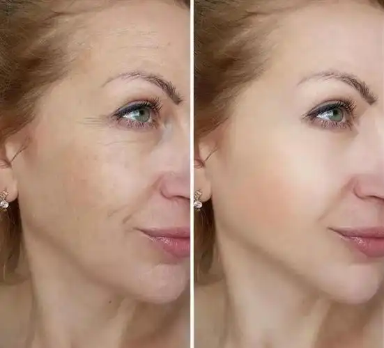 油性皮肤隐藏的好处:耐老耐晒,不易长皱纹,过敏,干皮羡慕不来