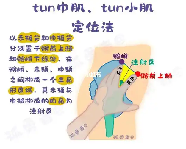 臀中肌臀小肌定位法