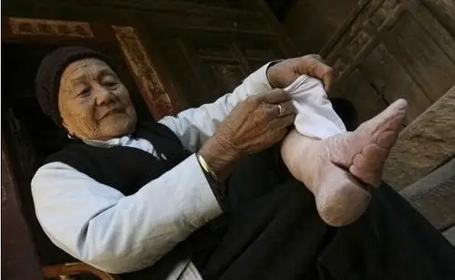 实拍三寸金莲:清末妇女裹脚缠足文化