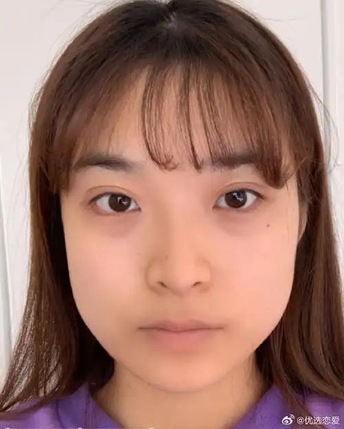 都是蛮不错的,从业二十年往上,都是做颌面项目,下颌角,颧骨内推之类的