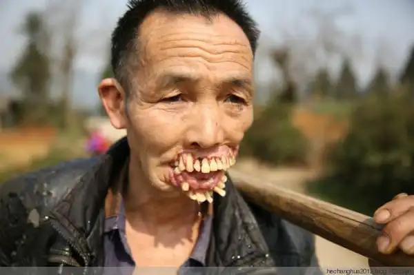 据他自述,几十年前狼多曾咬死数人,他11岁在山上看牛遇到了狼,或许因