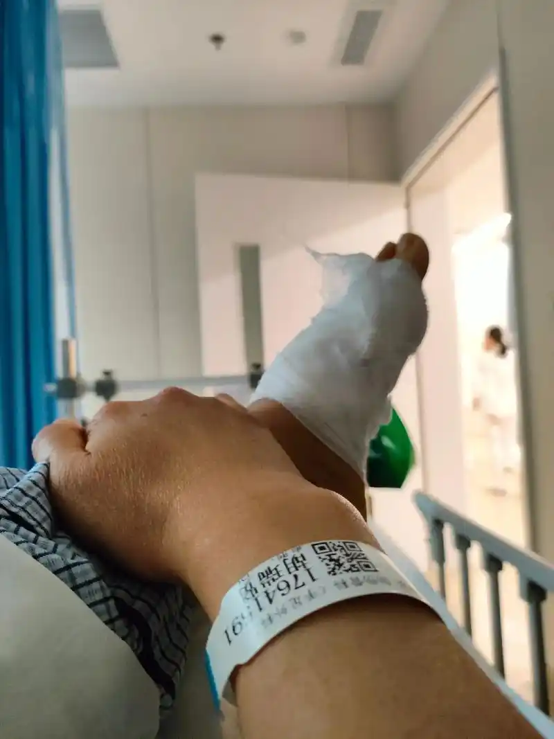 跖骨骨折的第10天住院的第3天,明天终于可以出院了,剩下的时 - 抖音