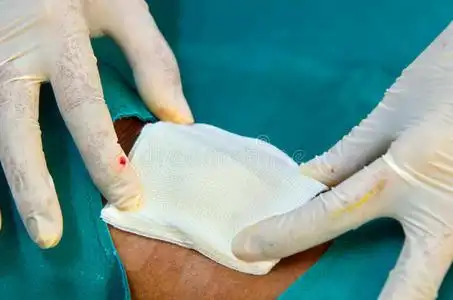 大腿伤口包扎纱布包扎伤口照片