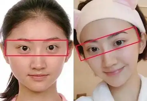 人间真实景甜做双眼皮惨变悲伤蛙真正的美是恰到好处