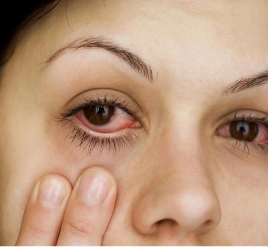 眼睛干涩有异物感不打紧?小心干眼症损害视力! - 深圳新安希玛林顺潮