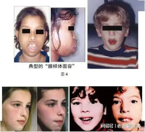 用嘴巴呼吸好吗