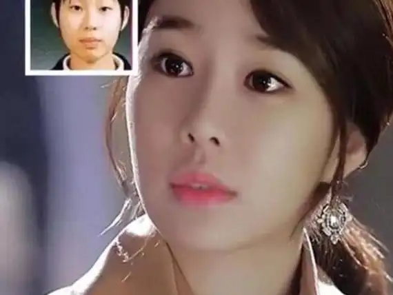 众所周知,韩国和日本都是名副其实的整形大亨,但是在_圈子-新氧美容