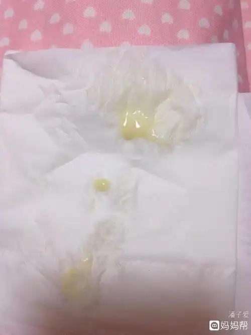 响亮!最正常的白带图片"风和日丽"-第2张图片-暖宝博客