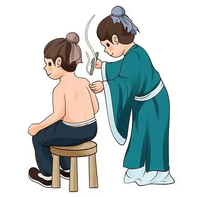 卡通手绘中国风艾灸插画艾灸疗养的女子半身背影插画原创插画海报中医