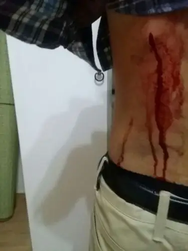 关注校园暴力行凶事件