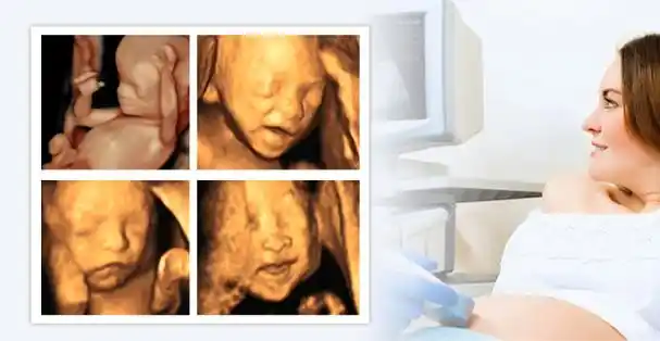 为什么要做四维彩超 为什么要做四维彩超检查