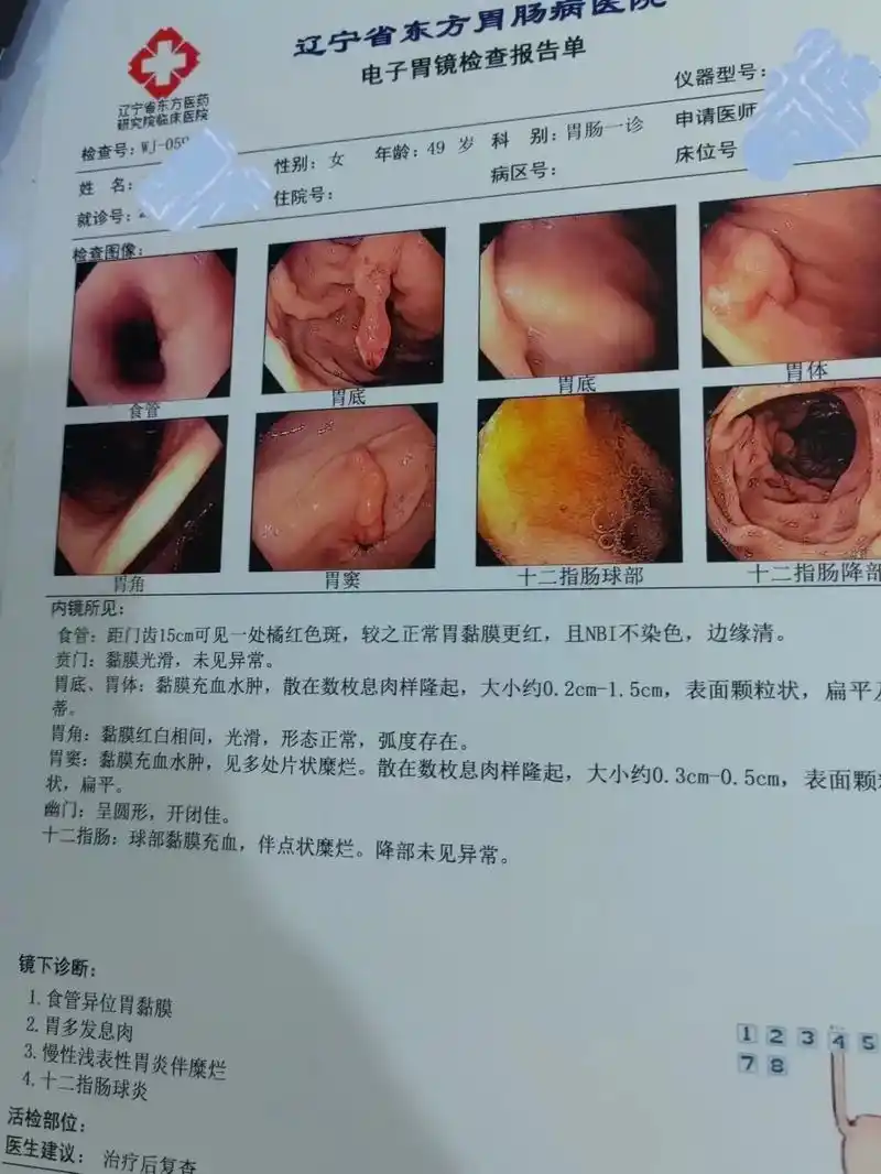 分享一下做胃肠镜的过程,因为老是胃里反酸,烧心,肠胃也一直不 - 抖音