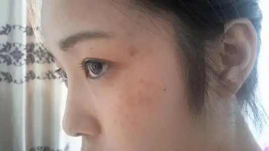 保持面部皮肤的整洁干净,是每个女性所追求的,即使进入中年阶段,也不