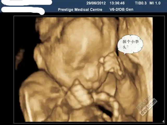 你想从四维里看出男宝宝,女宝宝吗?