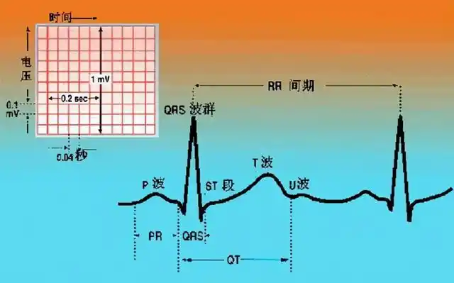 看心电图是不是能查出心肌缺血(你问我答心电图判断心肌缺血准吗)(4)