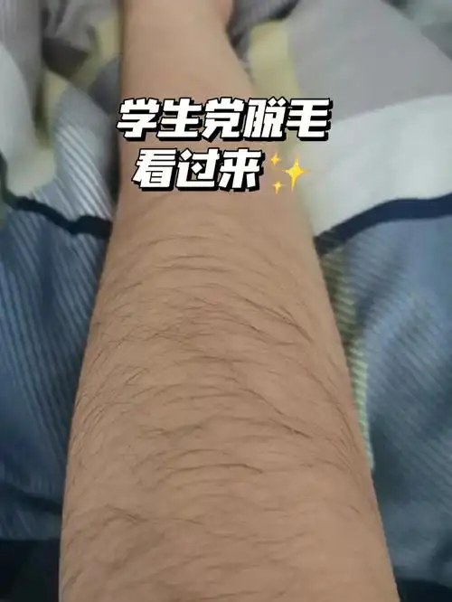 我傻了猕猴桃女孩脱毛后也能翻身逆袭