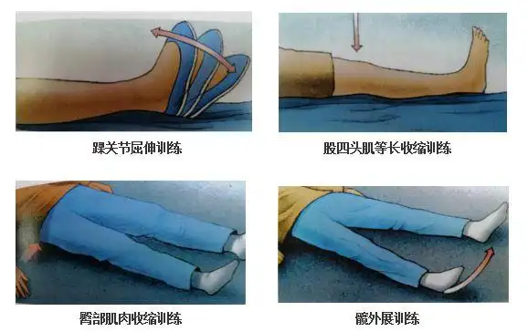 髋关节置换术后,想要恢复快,康复训练少不了|肌肉|肌群|骨折_网易订阅