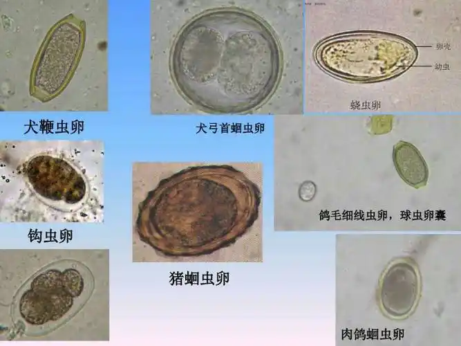 寄生虫卵检查