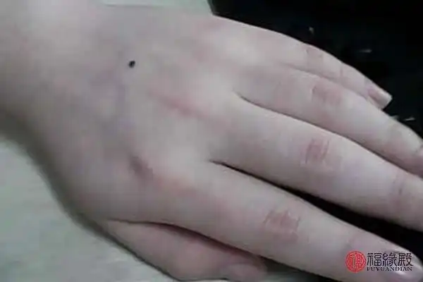 女人手背有痣代表什么