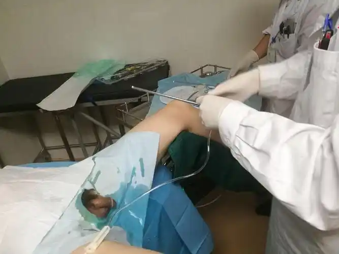 膀胱镜检查过程