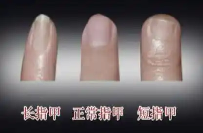 7.1标准的指甲——表示先天遗传正常,身心健康,聪明能干