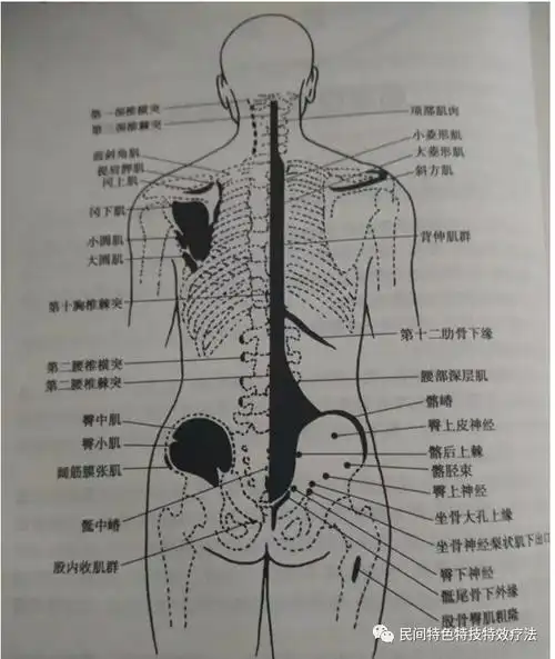 损伤引起的疼痛,无论是身体的哪个部位,如头部,颈部,肩部,胸背部,腰部