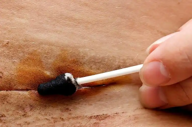 顺产的伤口一般是生产时会阴撕裂或侧切导致的,相较于剖腹产的伤口要