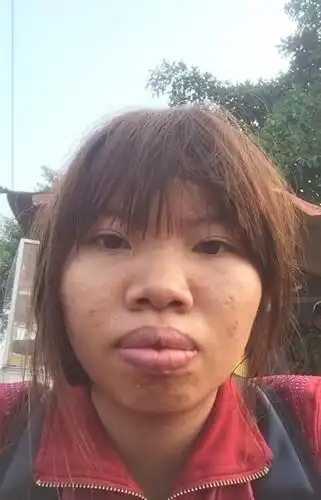 越南爆唇女相亲遭呛 整形后秒嫁风度男子