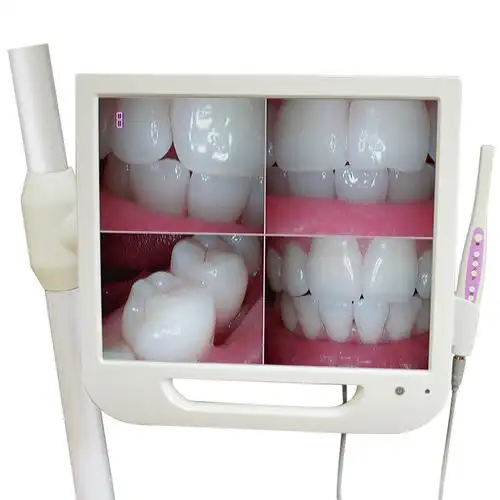 悦富500万像素口腔内窥镜一体机hd-a