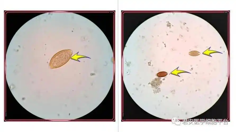 鞭虫及其虫卵美图鉴赏之升级版_河南省