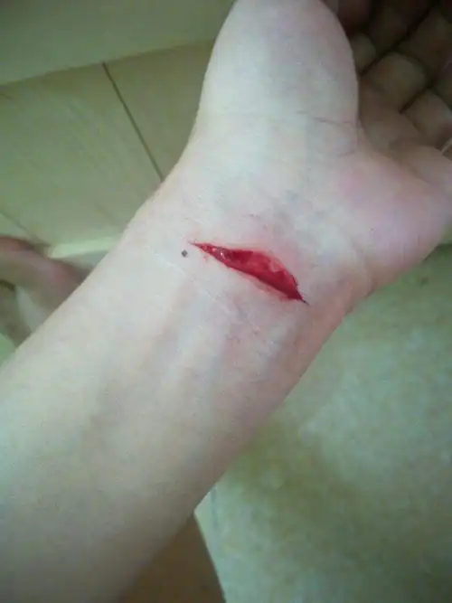 追问 要做到的就不会在两小时内割腕自杀了