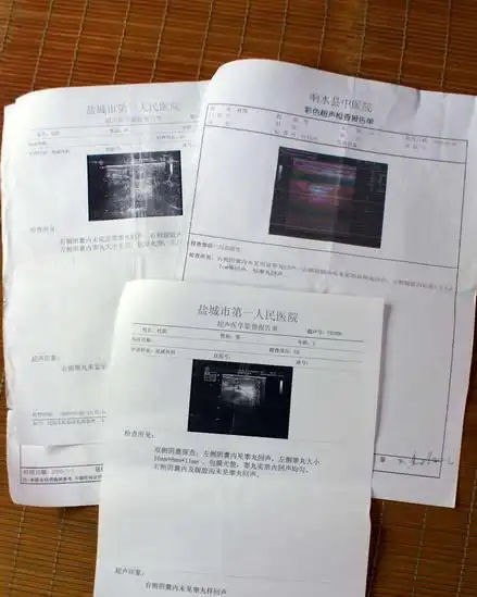 男童经2次手术后睾丸缺失(组图)