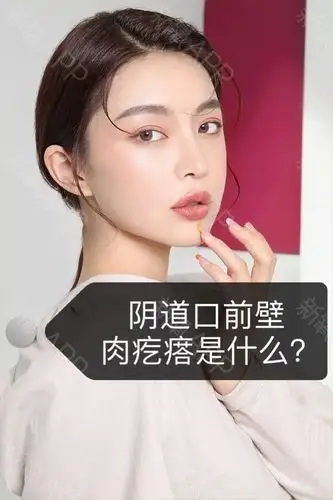 很多女性会问我,为什么我在阴道口前壁会摸到一个肉疙_圈子-新氧美容