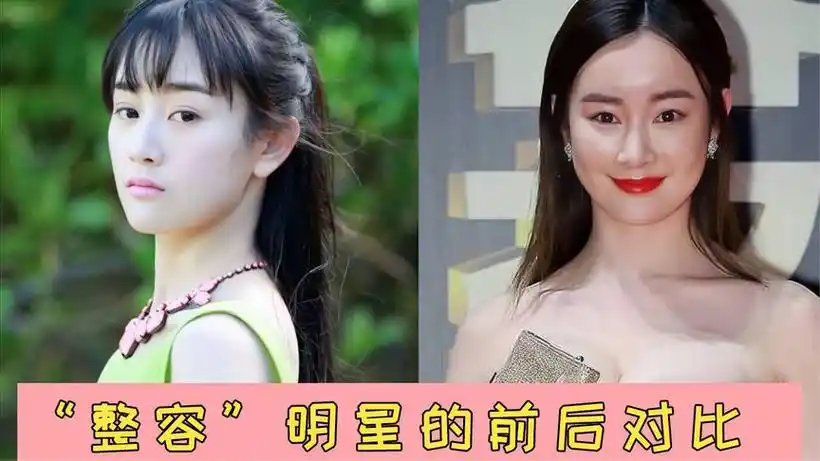 整容明星的前后对比,张檬自毁前程,陈小纭十年换头彻底逆袭