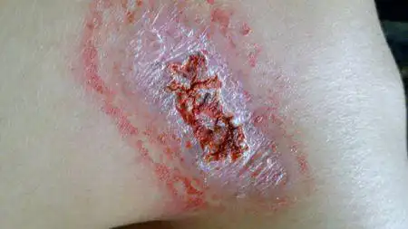 这个伤口是怎么了?