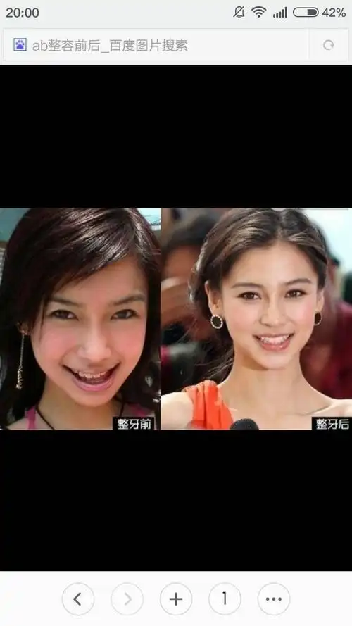 angelababy是否整容?最好有图片.