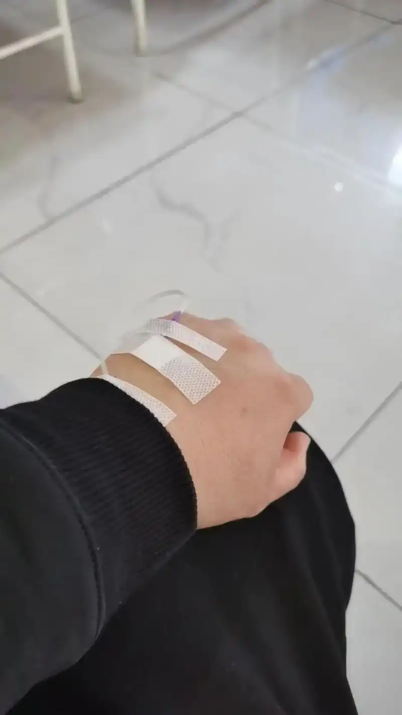 上午针灸下午静脉注射第二天早日战胜咳嗽