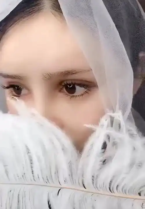 欧式芭比双眼皮