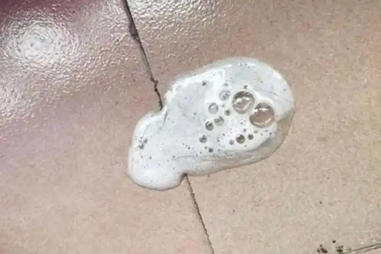 怎么判断是不是手足口病图片_有来医生