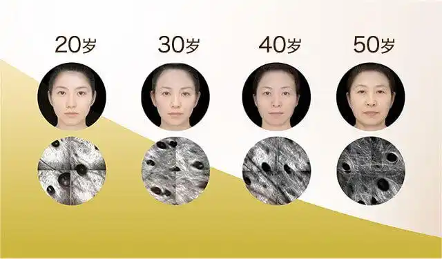 不同年龄对比效果