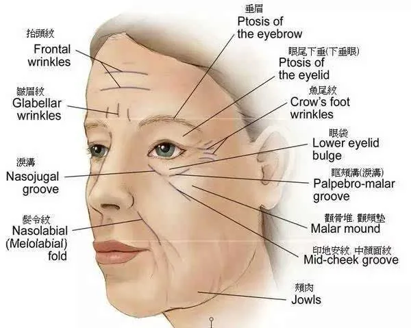 骂一首歌,歌词大意是女人三十岁了还没有嫁人,已经有皱纹了真的好可怜