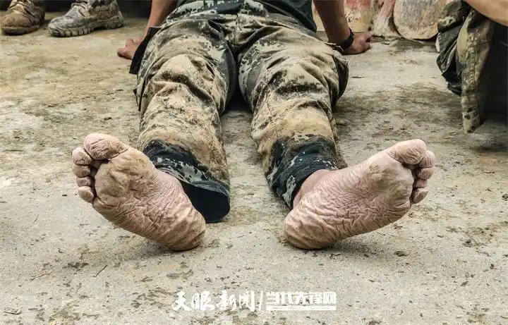 被水冲泡过的战士双脚.jpg