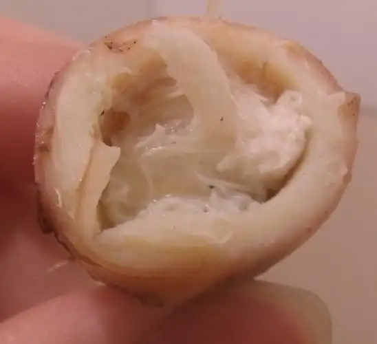 刚刚吃鱿鱼里面有白色的丝丝,爸爸说是线虫,,,怎么办我好像吃了,,有事