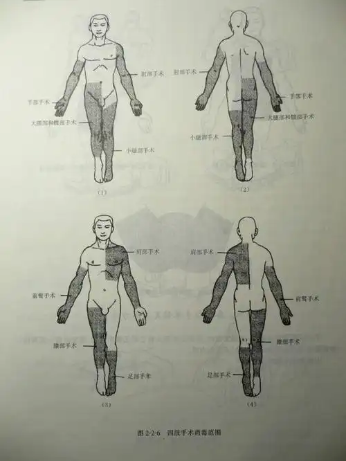 [原创]手术区皮肤的消毒范围(图解版-希望对大家的理解有所帮助)