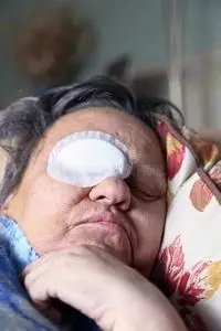 眼部包扎病人照片