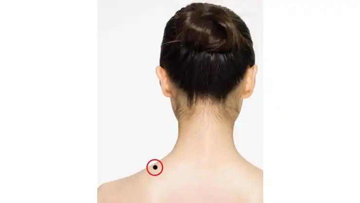 一,后背脖子和肩部相接处有痣我们称之为"财运和命运的交接点",此处痣