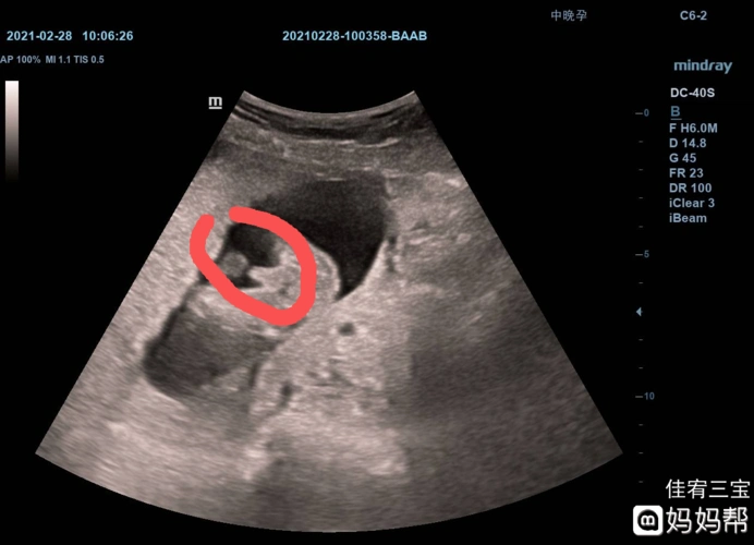 欢喜!医生说怀男孩的特点"典型案例"-第2张图片-木瓜博客