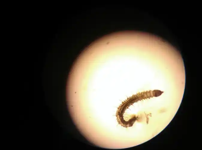 身为医生的父亲好紧张,第二天上班立刻找到我,并拿虫子让我看,显微镜