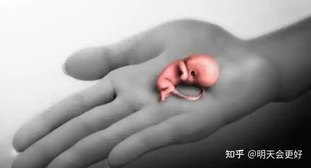 40天流产的胚胎图片 太揪心了 - 知乎