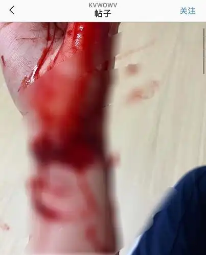 权珉娥再次更新ins发文,疑是再次自杀留下遗书